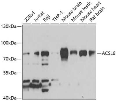 Western Blot: ACSL6 Antibody [NBP2-92246] - Western blot analysis of extracts of various cell lines, using ACSL6 antibody (NBP2-92246) at 1:1000 dilution. Secondary antibody: HRP Goat Anti-Rabbit IgG (H+L) at 1:10000 dilution. Lysates/proteins: 25ug per lane. Blocking buffer: 3% nonfat dry milk in TBST. Detection: ECL Basic Kit. Exposure time: 90s.